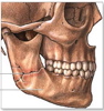 FacialFracture's Avatar