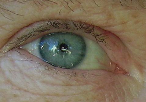 eye
